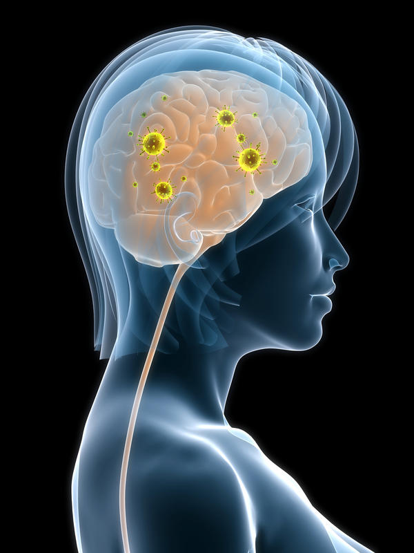 What Is Asymptomatic Neurosyphilis;What Does It Do