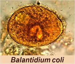 What Is Balantidium Coli Parasite;What Does It Do