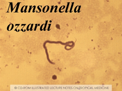 What Is Mansonella Ozzardi;What Does It Do?