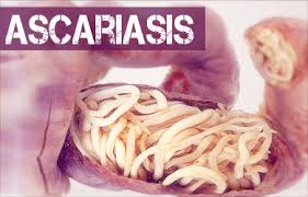 What Is Ascariasis Disease;Treatment,Diagnosis And Prevention