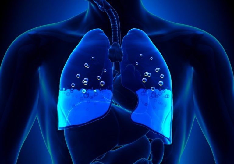 What Is Pulmonary Edema;Symptoms And Causes