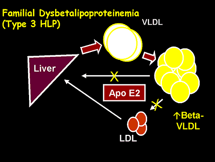 Familial Dysbetalipoproteinemia