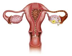 What Is Fibroids;What Does It Do In Our Body?